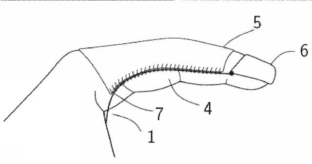 6717851-人口腱の取付け方法および製品 図000003