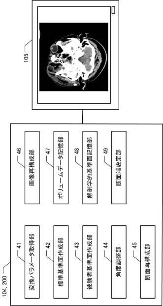 6731870-医用断面表示装置及び断面画像表示方法 図000003