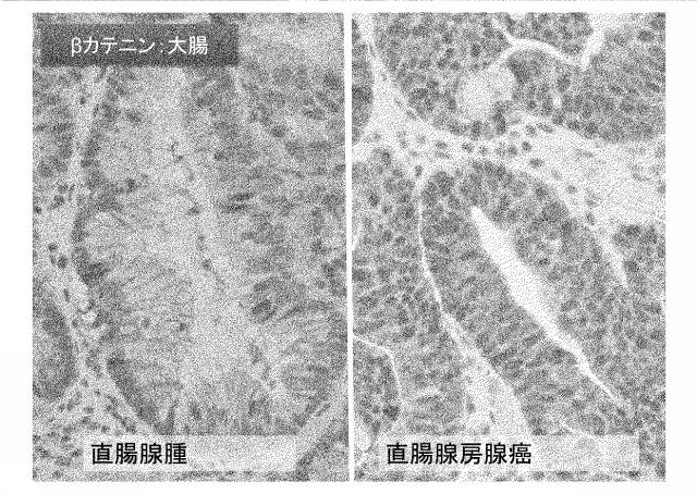 6963271-イヌの遺伝性消化管腫瘍症の遺伝子診断法 図000003