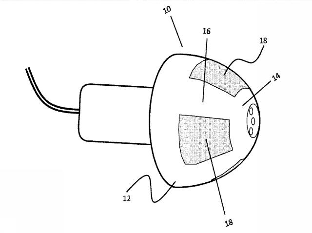 6965203-聴覚機器のための閉塞制御システムおよび聴覚機器 図000003