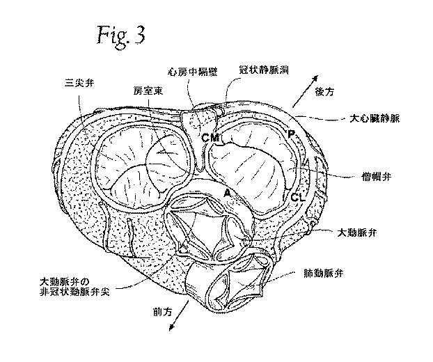 5647680-一体的な迅速接続人工心臓弁ならびに配備のシステムおよび方法 図000004