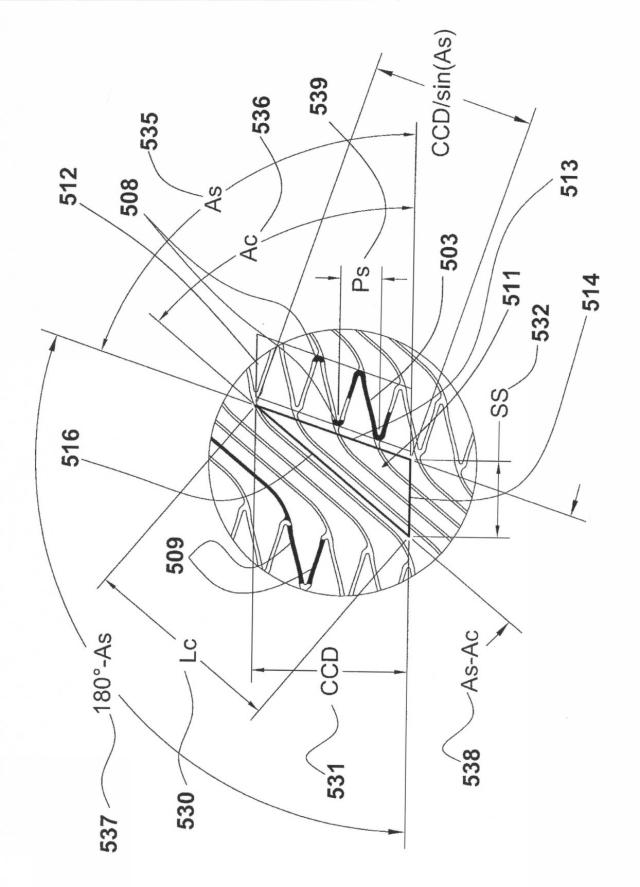 5649965-フレキシブルステント 図000004