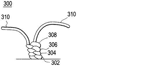 5823110-ステントグラフトの縫合糸のロック 図000004