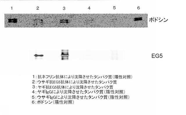 5830329-腎障害の新規マーカー 図000004