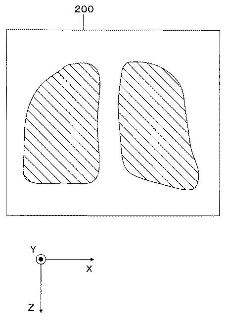 5835881-医用画像処理装置、及び医用画像処理プログラム 図000004