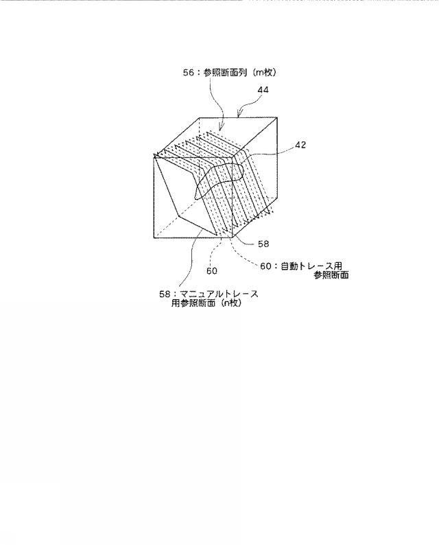 5841771-超音波データ処理装置 図000004