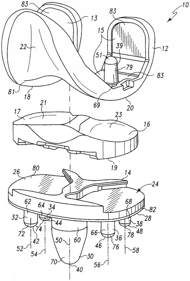 5916989-異なる質感を有する表面を備えた人工関節及びその人工関節の作製方法 図000004