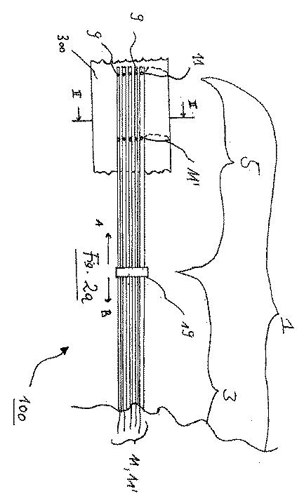 6027540-個々の軸状ファイバーを含む装置、及び医療用インプラントを折り畳み又は展開するための組み合わせ装置 図000004
