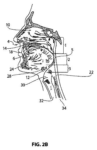 6057889-睡眠時無呼吸の治療システム及び方法 図000004