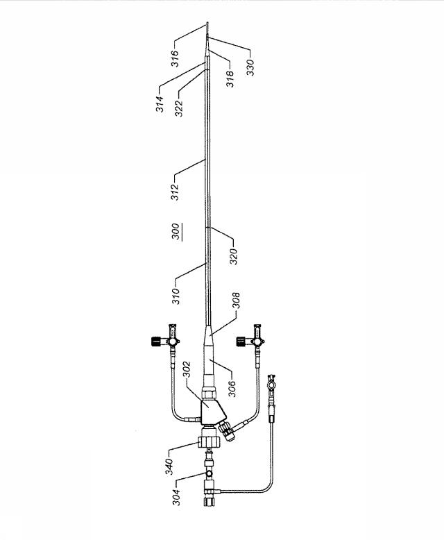 6069392-拡張可能な腸骨シースと使用方法 図000004