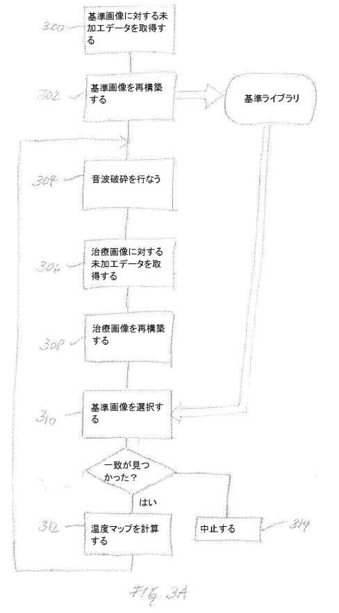 6138162-非侵襲的療法中の参照ベースの動き追跡 図000004