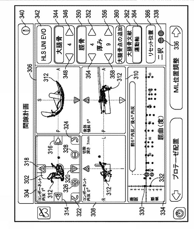 6151429-関節プロテーゼを配置する位置を判断するためのシステム及び方法 図000004