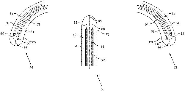 6219023-カテーテルの偏向を指示するためのシステム 図000004