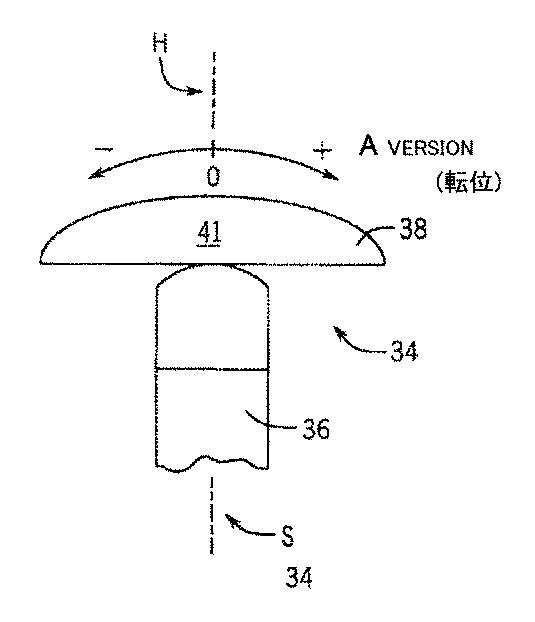 6495190-可変傾斜上腕骨ヘッドコンポーネント付きの肩プロテーゼ 図000004