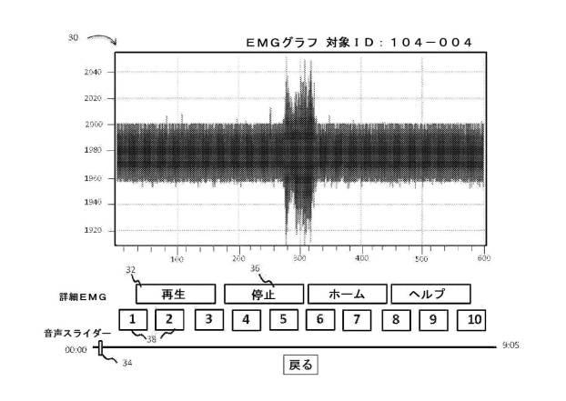 6505708-データ統合インターフェースならびに筋電図記録データおよび音声データを検討する方法 図000004