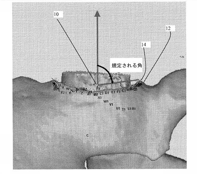 6525582-股関節の面再建 図000004