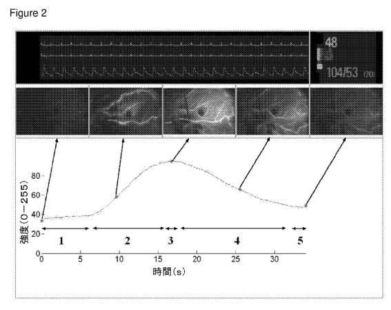 6561180-血管造影及びかん流の定量化並びに解析手法 図000004