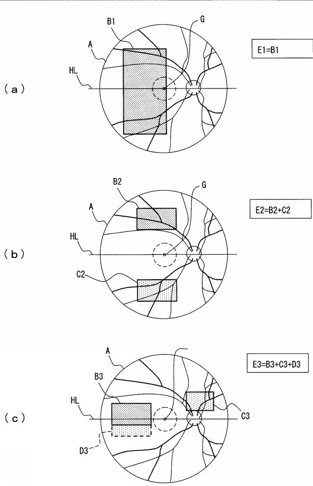 6580998-視野計 図000004