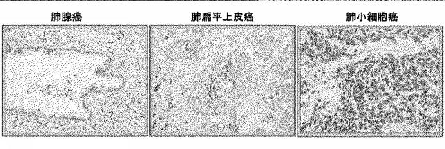 6609867-癌治療薬剤ならびに治療方法 図000004