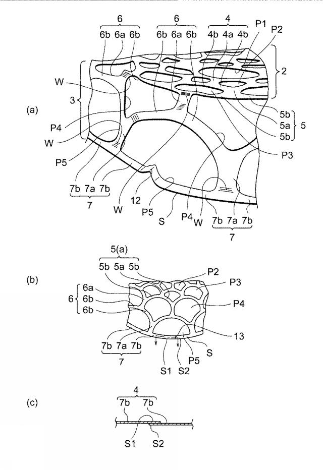 6622490-治療用治具 図000004