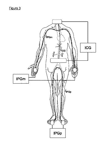 6637175-両手又は両足の先端の測定値から動脈内の脈拍の伝搬時間を見積もる方法と装置。 図000004