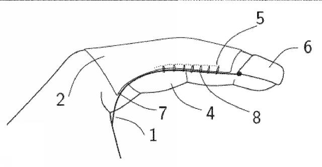 6717851-人口腱の取付け方法および製品 図000004