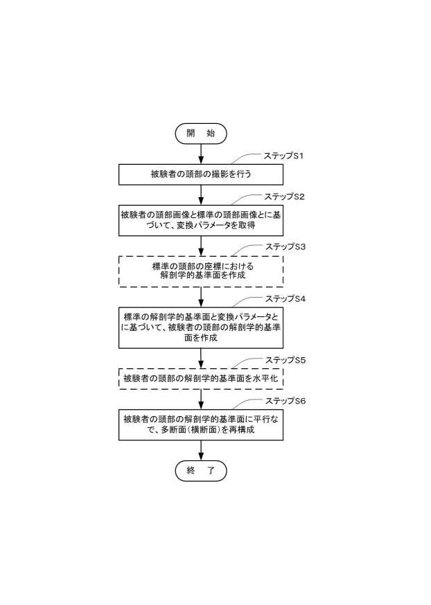 6731870-医用断面表示装置及び断面画像表示方法 図000004