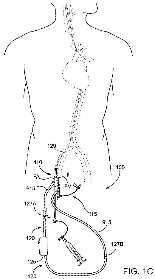 6768697-頚動脈血流の逆流を確立する方法およびシステム 図000004