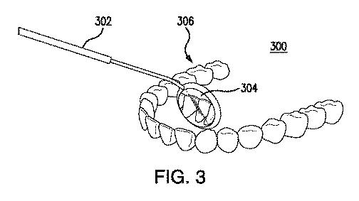 6905540-統合されたカメラを有する歯科ミラーおよびそのアプリケーション 図000004