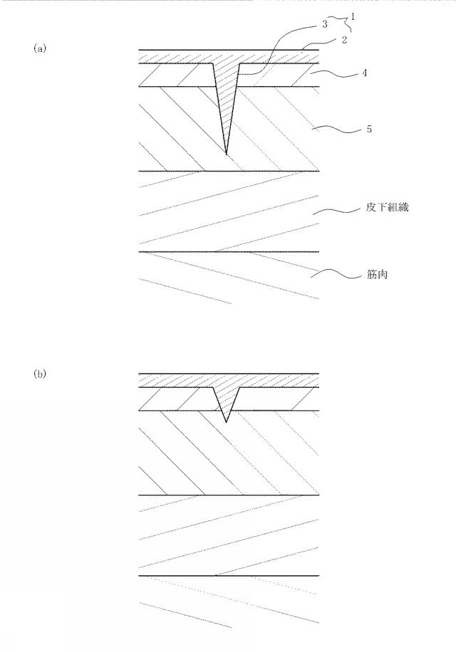 6959453-肌改質シート 図000004