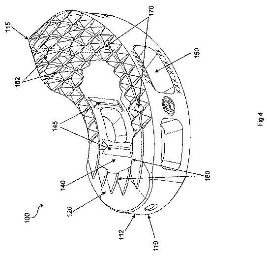 5683026-自己ピボット式脊椎インプラント及び関連器具 図000005