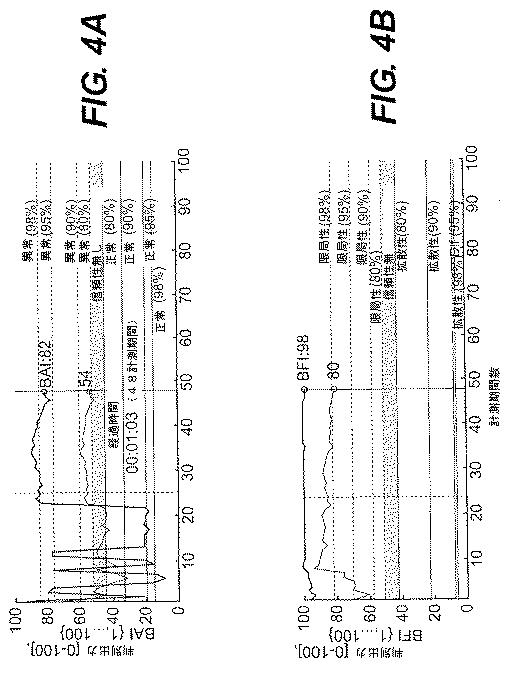 5717651-脳機能の確率的客観的査定のための方法および装置 図000005