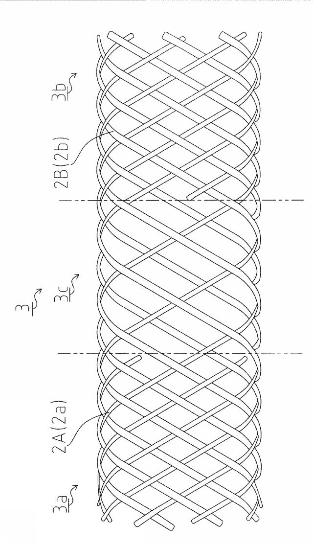 5751619-ステント 図000005