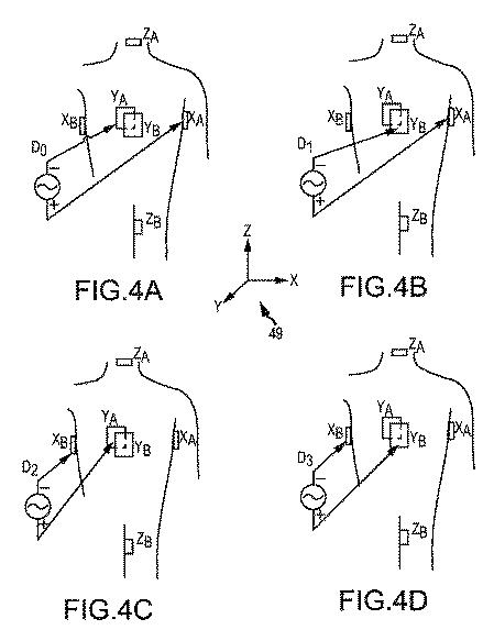 5823635-電気生理学マップを構築するためのシステム及びその処理装置の作動方法 図000005