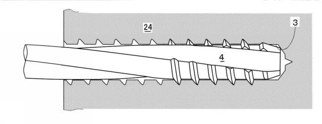 5830304-ラグスクリューの木製構造部材螺着方法 図000005