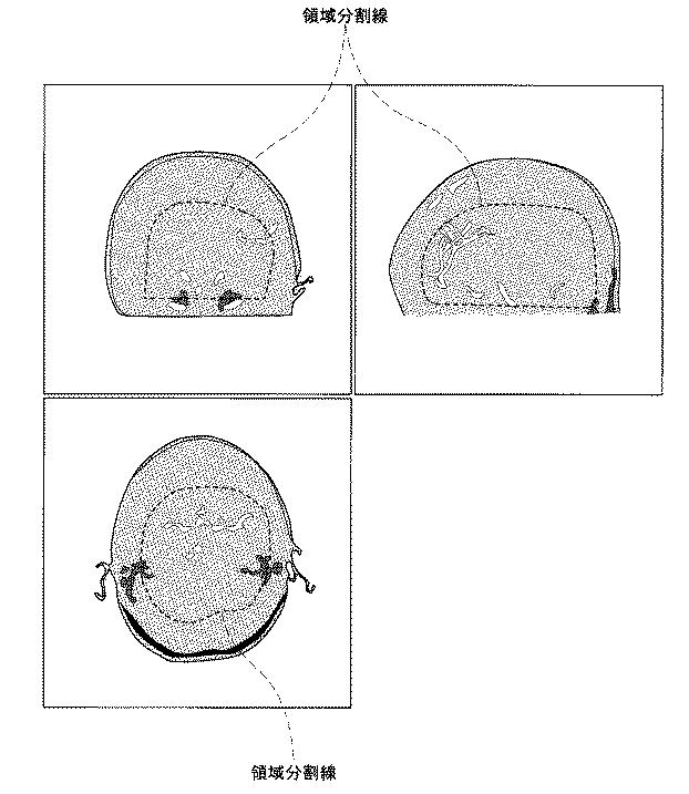 5835912-医用画像診断装置および医用画像処理装置 図000005