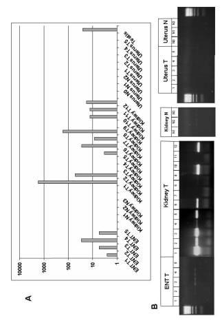 5922159-腫瘍診断と治療のための表面関連抗原の同定 図000005