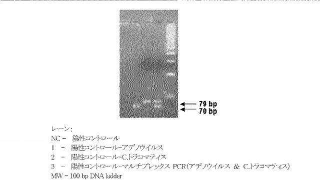 5927243-眼および中枢神経系の細菌、真菌、寄生虫およびウイルス感染の同時検出と識別のための新規な方法 図000005