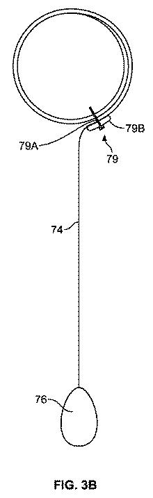 6109735-回転モータにより電力を供給される建築物の開口部遮蔽物 図000005