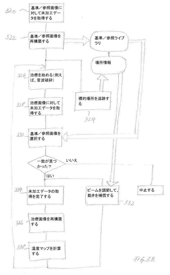 6138162-非侵襲的療法中の参照ベースの動き追跡 図000005