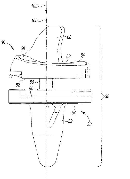 6362884-外科用器具及び使用方法 図000005