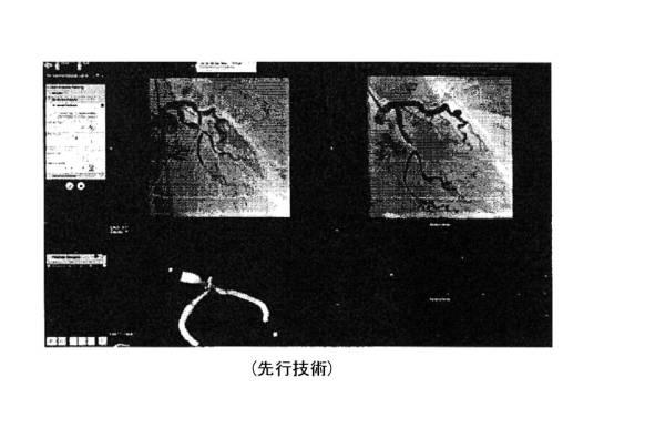 6396310-第一レンダリング投影と第二レンダリング投影との間のトランジションをユーザーに表示するための方法および装置 図000005