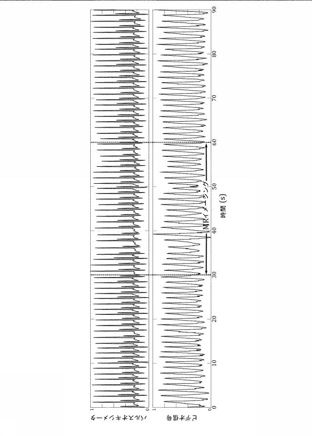 6426201-同時磁気共鳴イメージング中の非接触式生理学的モニタリング 図000005