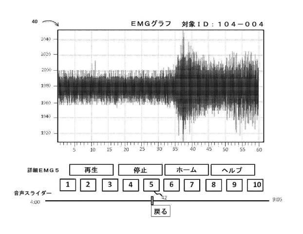 6505708-データ統合インターフェースならびに筋電図記録データおよび音声データを検討する方法 図000005