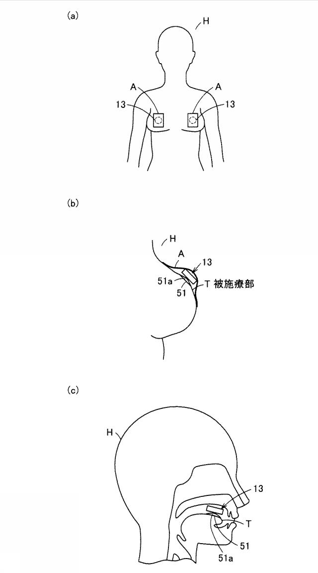 6551955-マッサージ装置及びその振動子ユニット 図000005