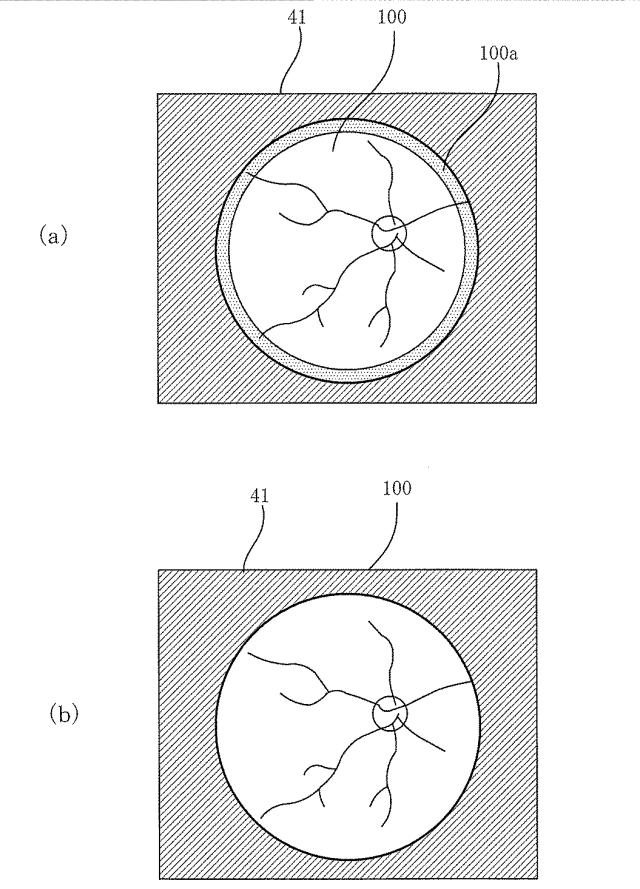 6592249-眼底撮影装置 図000005