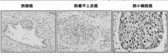 6609867-癌治療薬剤ならびに治療方法 図000005