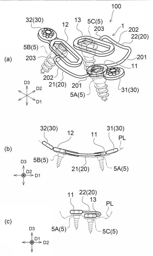 6770282-歯科矯正用インプラント装置に用いられるベース部材 図000005