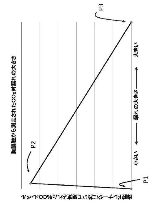 6791559-胸腔ドレナージシステム 図000005