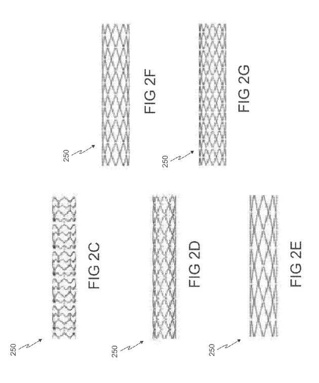 6793147-動脈瘤を治療するためのデバイスおよび方法 図000005